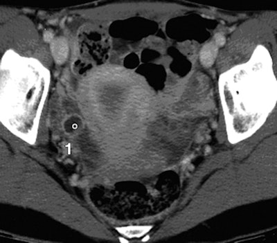 2008 09 16 13 13 47 539 2008 09 12 Ct Sensitivity 4 A Resized