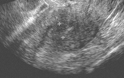 2008 09 16 13 13 50 120 2008 09 12 Ct Sensitivity 3 A Resized