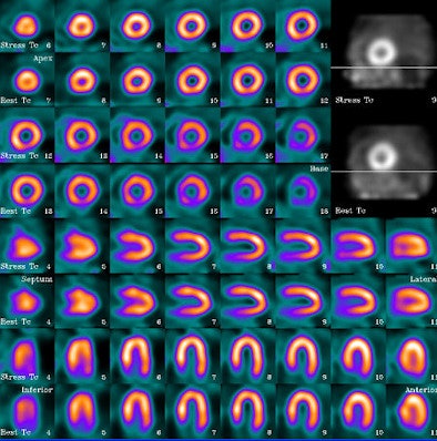 2008 09 17 09 31 34 521 Ufc Image Resized