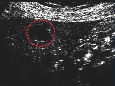 2008 09 23 12 06 30 921 Shiraishi correct Hcc