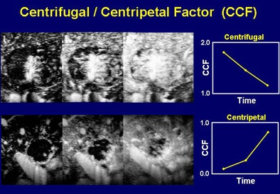 2008 09 23 12 06 33 899 Shiraishi ccfbottom