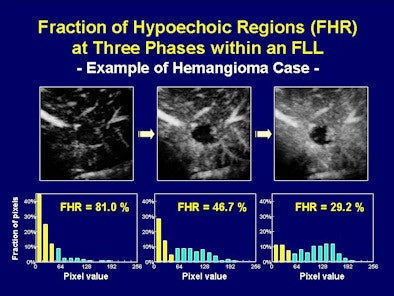2008 09 23 13 23 42 761 Shiraishi fhrbottom Resized2