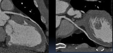 2008 09 29 10 16 08 171 Defrance artseliminated