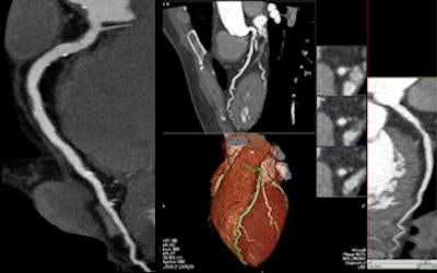 2008 09 29 10 16 09 641 Defrance 44yo