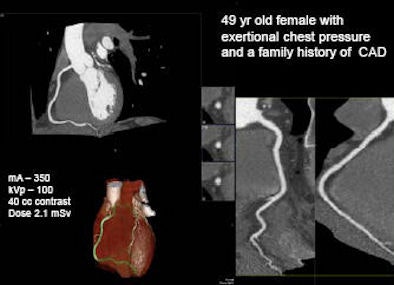 2008 09 29 10 16 09 711 Defrance 49 female