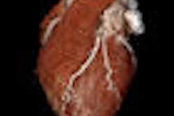 2008 09 29 10 16 10 516 Defrance thumb 10 08