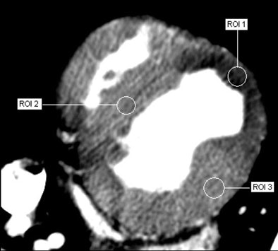 2008 09 30 10 49 27 951 Defrance adenosinestress