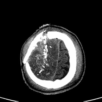 2008 10 14 13 54 30 862 Image B Resized