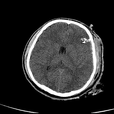 2008 10 14 13 54 31 559 Image A Resized