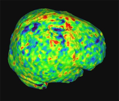 2008 10 15 10 46 45 683 Orrisson bottom 45yo