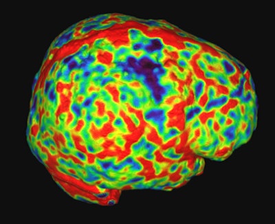 2008 10 15 10 46 48 242 Orrison top 45yo