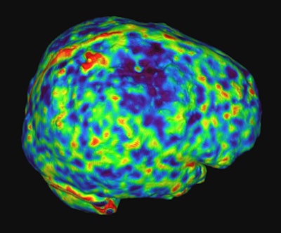 2008 10 15 10 46 51 719 Orrisson seconddown 45yo