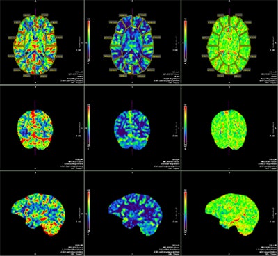 2008 10 15 10 55 57 387 77yo Fcarotid Bruitp C Tperfbottom