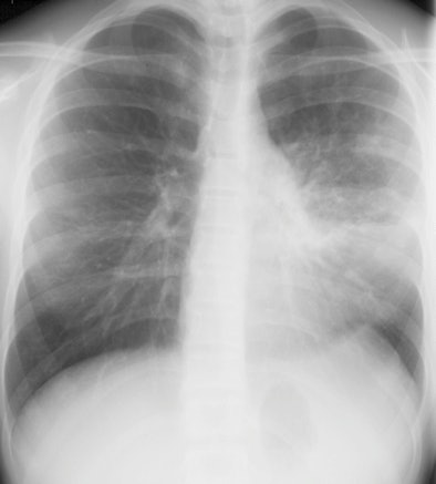 2008 10 15 17 28 56 494 2008 10 16 Peltola2 A Resizedv2