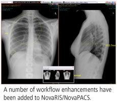 2008 10 21 13 52 34 980 Novarad Pac 2008 Road