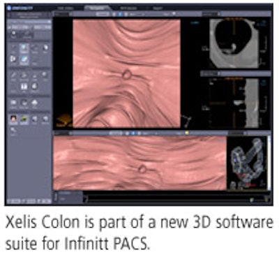 2008 10 21 17 51 44 96 Infinitt Pac 2008