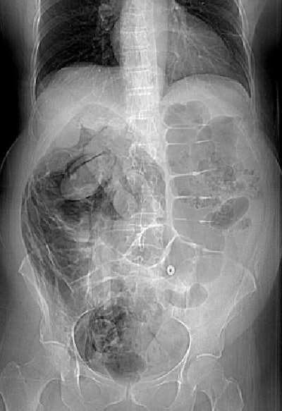 2008 10 23 15 35 42 517 Hough bottom