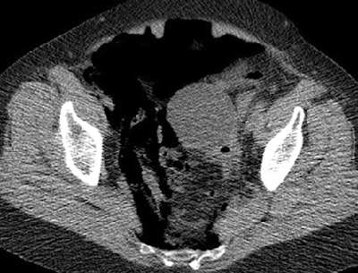 2008 10 23 15 35 46 811 Hough below