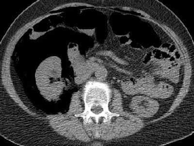 2008 10 23 15 35 48 414 Hough top