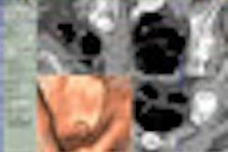 2008 10 27 13 14 52 840 Medicsight Thumb Cad 2008