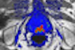 2008 10 27 13 14 53 453 Icad Thumb Cad 2008