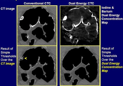 2008 10 29 10 38 21 878 Goshen ex1bottom