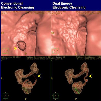 2008 10 29 10 38 24 352 Goshen ex1 top jpg