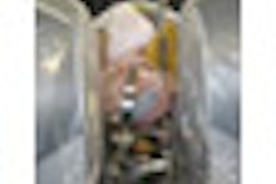 2008 10 30 09 36 41 538 Medtronic Thumb Mri 2008