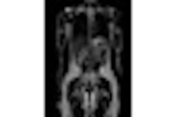 2008 10 30 09 37 13 318 Siemens Thumb Mri 2008