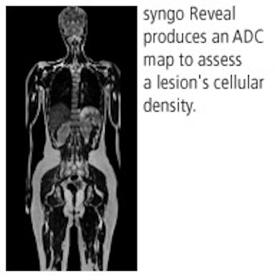 2008 10 30 09 37 13 659 Siemens Mri 2008