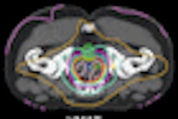 2008 10 30 15 19 27 101 Radonc Vmat Thumb