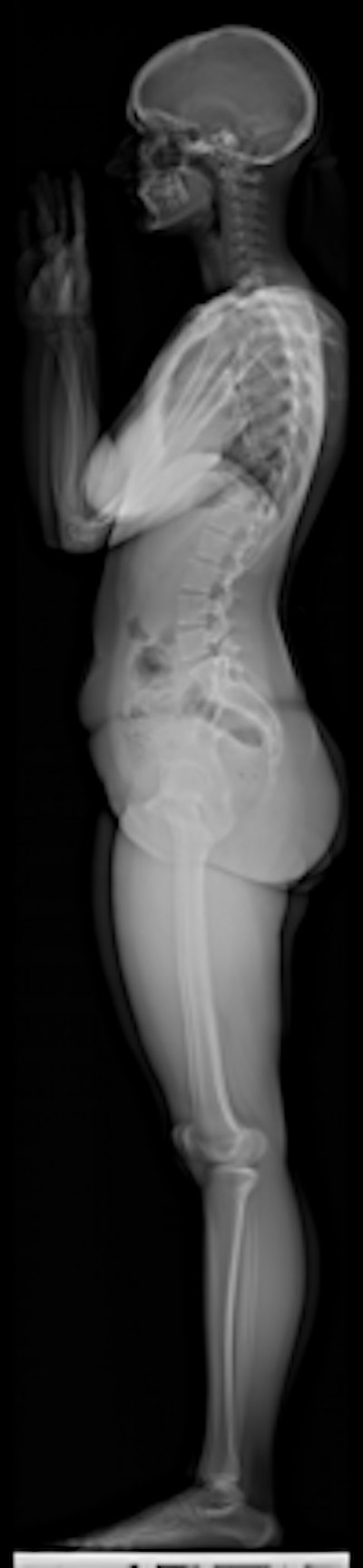 2008 10 29 13 56 43 681 Eos Patient 01 Profilv4