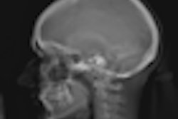 2008 10 29 14 02 32 961 Eos Patient 01 Profil Thumb