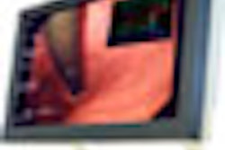 2008 10 31 11 04 25 416 Fimi Philips Thumb Med 2008