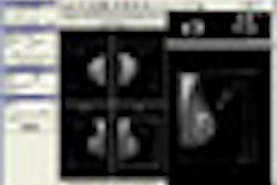 2008 11 03 10 40 39 308 Vidar Thumb Paa 2008