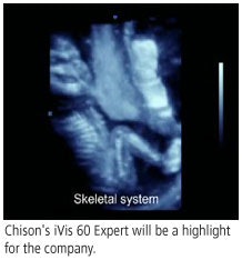 2008 11 03 16 23 07 165 Chison Ult 2008