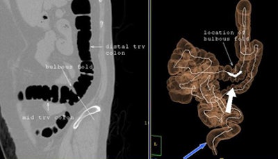 2008 11 03 17 40 01 890 Zafar priorhysterectomy