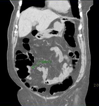 2008 11 03 17 40 04 113 Zafar 78yowoman