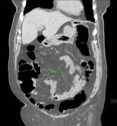 2008 11 03 17 40 04 113 Zafar 78yowoman