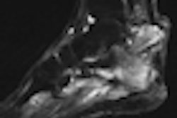 2008 11 04 16 03 39 37 Thumb Osteo