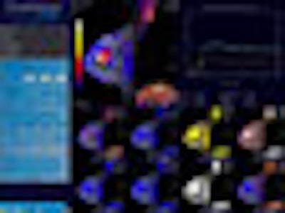 2008 11 05 12 56 11 974 Biotronic Thumb Adv 2008