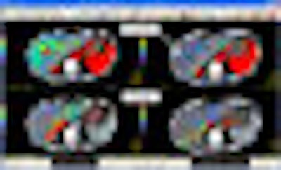 2008 11 05 12 56 12 298 Apollo Thumb Adv 2008
