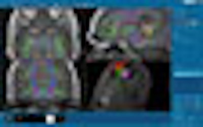 2008 11 05 12 57 04 983 Medtronic Thumb Adv 2008