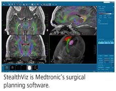 2008 11 05 12 57 05 412 Medtronic Adv 2008