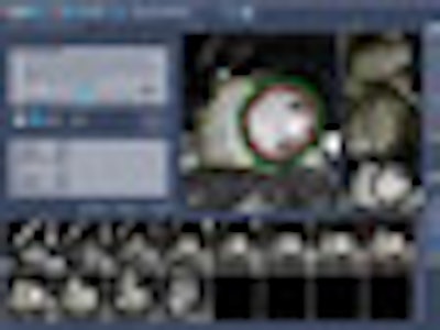 2008 11 05 12 57 05 56 Medis Thumb Adv 2008