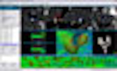2008 11 05 12 57 30 333 Rendoscopy Thumb Adv 2008