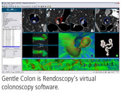 2008 11 05 12 57 30 479 Rendoscopy Adv 2008