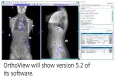 2008 11 05 12 57 31 496 Orthoview Adv 2008
