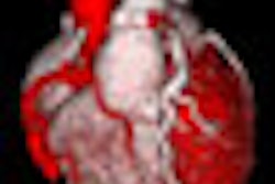 2008 11 05 12 57 50 185 Terarecon Thumb Adv 2008