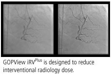 2008 11 05 13 04 47 543 Contextvision2 Adv 2008